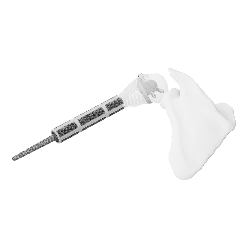 Customized Shoulder Joint