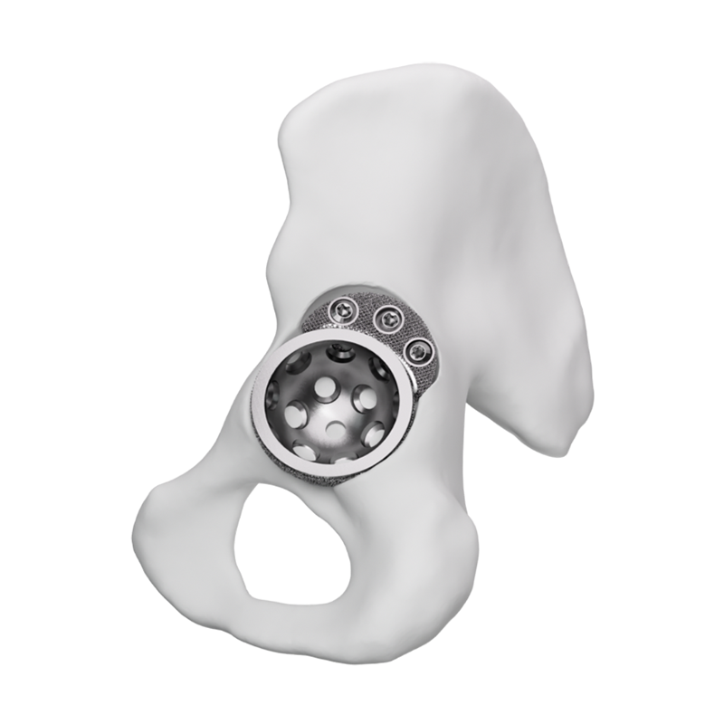Porous Tantalum Hip Joint Augment II