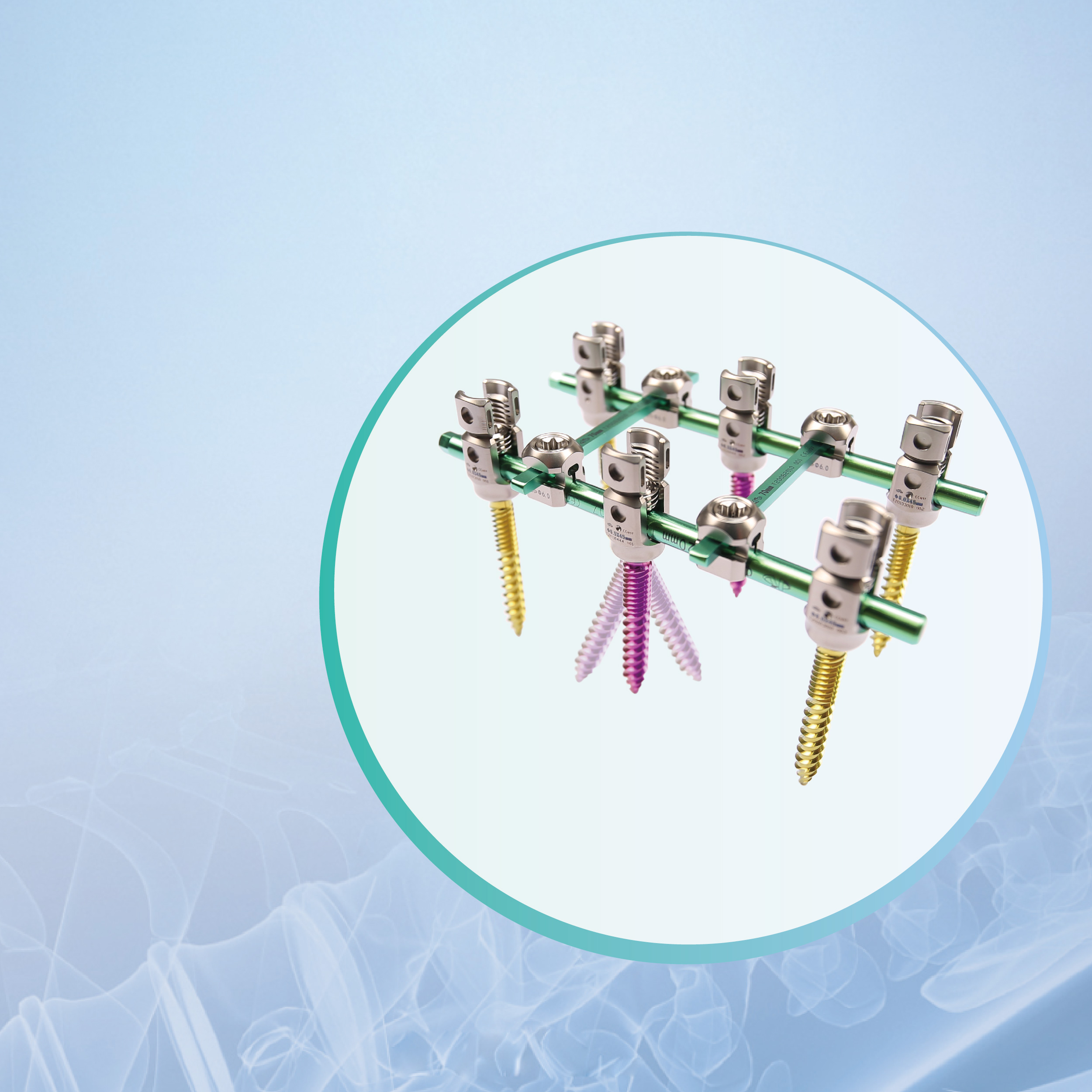 Forticore 5.5 Spinal Fixation System