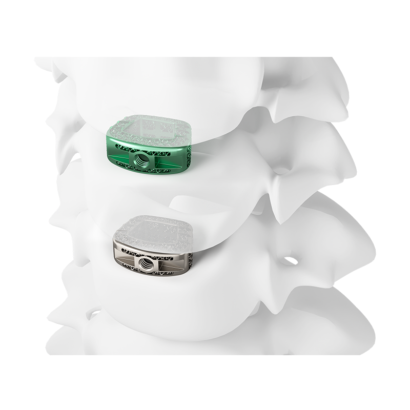 3D Printed Anterior Cervical Interbody Fusion Cage